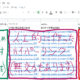 HSK3.0単語一覧とネット辞書（コトバンク・weblio）